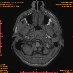 2025-06-14/AX MPR/0034-IM639.png