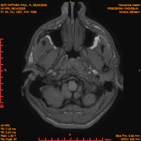 2025-06-14/AX MPR/0035-IM640.png