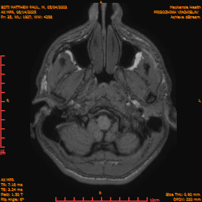2025-06-14/AX MPR/0036-IM641.png