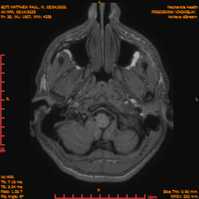 2025-06-14/AX MPR/0037-IM642.png