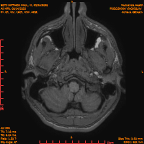 2025-06-14/AX MPR/0038-IM643.png