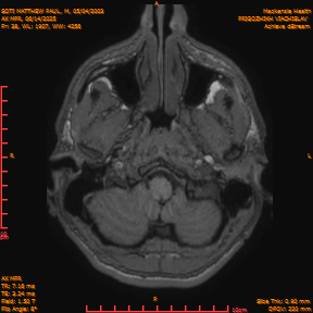 2025-06-14/AX MPR/0039-IM644.png
