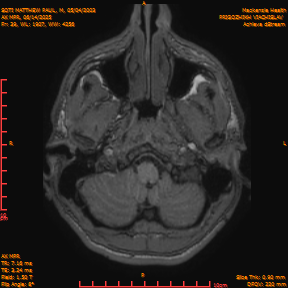 2025-06-14/AX MPR/0040-IM645.png