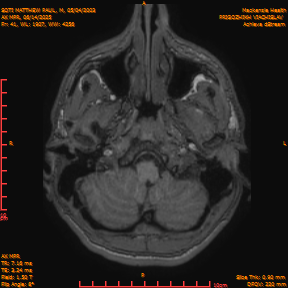 2025-06-14/AX MPR/0042-IM647.png