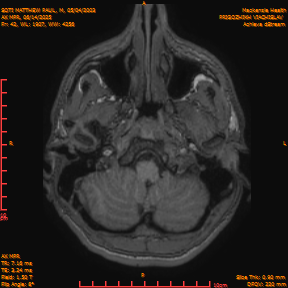 2025-06-14/AX MPR/0043-IM648.png