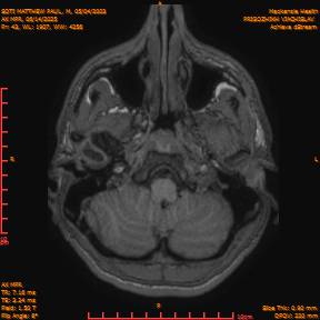 2025-06-14/AX MPR/0044-IM649.png