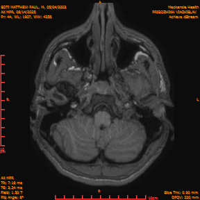 2025-06-14/AX MPR/0045-IM650.png