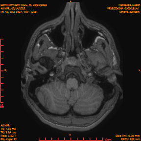 2025-06-14/AX MPR/0046-IM651.png