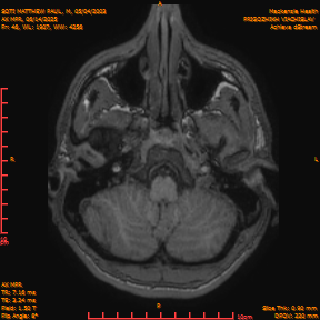 2025-06-14/AX MPR/0047-IM652.png