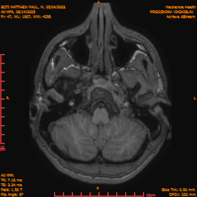 2025-06-14/AX MPR/0048-IM653.png