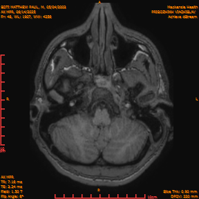 2025-06-14/AX MPR/0049-IM654.png