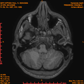 2025-06-14/AX MPR/0051-IM656.png