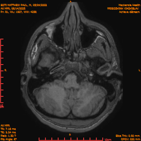 2025-06-14/AX MPR/0052-IM658.png