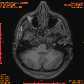 2025-06-14/AX MPR/0053-IM657.png