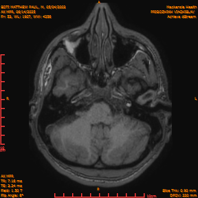 2025-06-14/AX MPR/0054-IM659.png