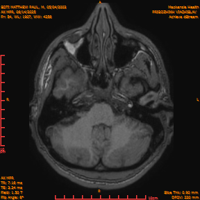 2025-06-14/AX MPR/0055-IM660.png