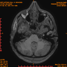 2025-06-14/AX MPR/0056-IM661.png