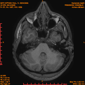 2025-06-14/AX MPR/0058-IM663.png