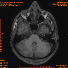 2025-06-14/AX MPR/0059-IM664.png