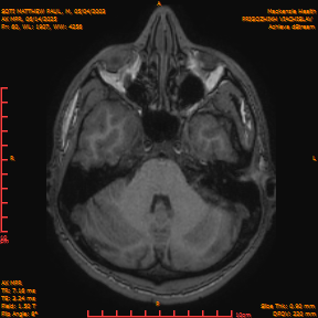 2025-06-14/AX MPR/0061-IM666.png