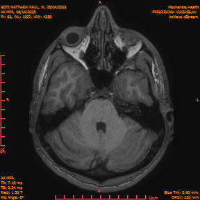 2025-06-14/AX MPR/0064-IM669.png