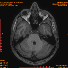 2025-06-14/AX MPR/0065-IM670.png