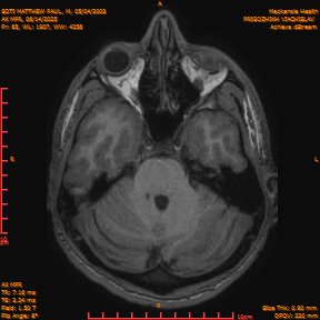 2025-06-14/AX MPR/0066-IM671.png