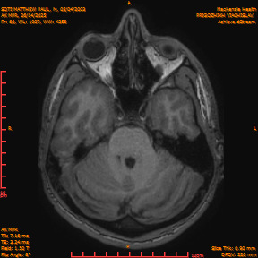 2025-06-14/AX MPR/0067-IM672.png