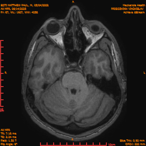 2025-06-14/AX MPR/0068-IM673.png
