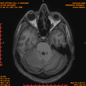 2025-06-14/AX MPR/0069-IM674.png