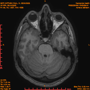 2025-06-14/AX MPR/0070-IM675.png