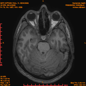 2025-06-14/AX MPR/0073-IM678.png