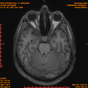 2025-06-14/AX MPR/0074-IM679.png