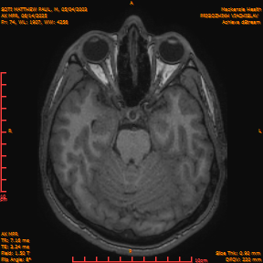 2025-06-14/AX MPR/0075-IM680.png