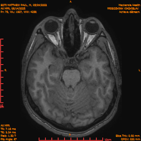 2025-06-14/AX MPR/0076-IM681.png