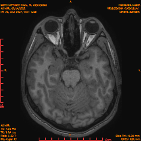 2025-06-14/AX MPR/0077-IM682.png