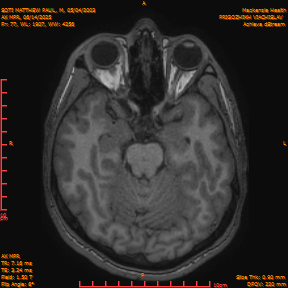 2025-06-14/AX MPR/0078-IM683.png