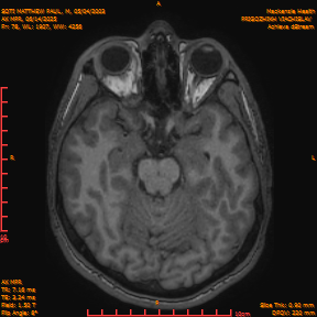 2025-06-14/AX MPR/0079-IM684.png