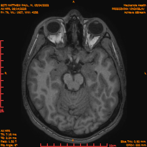 2025-06-14/AX MPR/0080-IM685.png