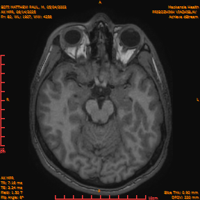 2025-06-14/AX MPR/0081-IM686.png
