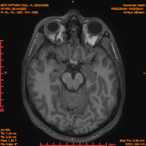 2025-06-14/AX MPR/0082-IM687.png