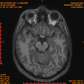 2025-06-14/AX MPR/0083-IM688.png