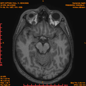 2025-06-14/AX MPR/0084-IM689.png