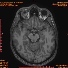 2025-06-14/AX MPR/0085-IM690.png