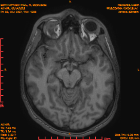 2025-06-14/AX MPR/0086-IM691.png