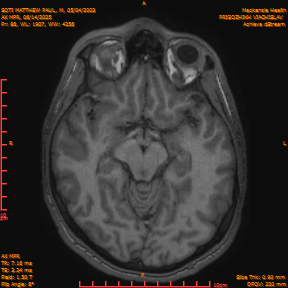 2025-06-14/AX MPR/0087-IM692.png