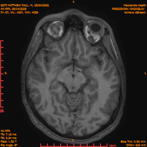 2025-06-14/AX MPR/0088-IM693.png