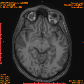 2025-06-14/AX MPR/0089-IM694.png