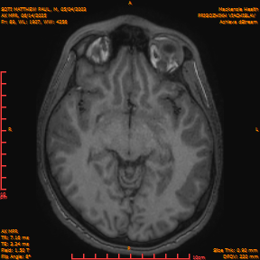 2025-06-14/AX MPR/0090-IM695.png