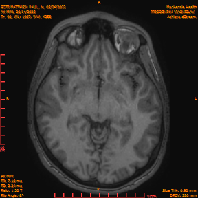 2025-06-14/AX MPR/0091-IM696.png